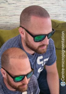 densité chez centre-micropigmentation Belgique